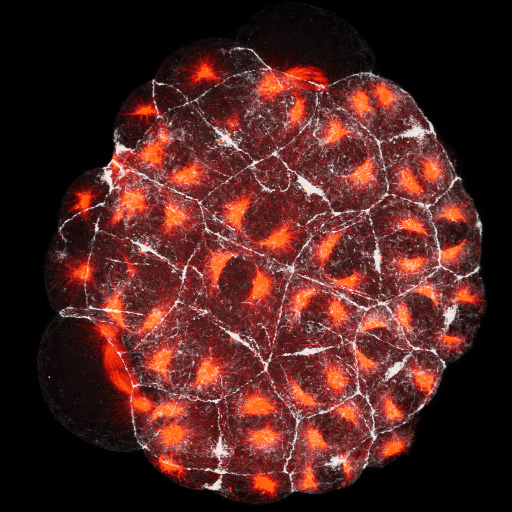 64 cell stage