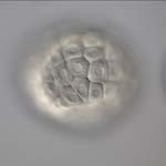 dendraster early blastula 2, thumbnail link to larger image in new window.
