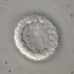 dendraster blastula 1, thumbnail link to larger image in new window.