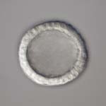 dendraster blastula 2, thumbnail link to larger image in new window.