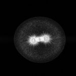 4metaphase