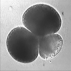 Scaphopod 
embryo, link to movie