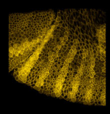 micro-photograph of "Sloppy-paired" gene